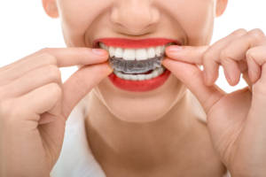 orthodontists asheville nc