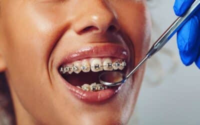 Braces Done Right: Choosing the Best Asheville Orthodontist