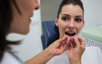 What You Should Know Before Getting Invisalign Aligners