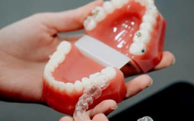 Navigating Invisalign: A Step By Step Guide To Straighter Teeth