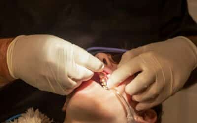 Adult Orthodontic Treatment Options For Fixing a Gap Between Teeth