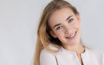 The Ultimate Guide to Metal Braces: Everything You Need to Know