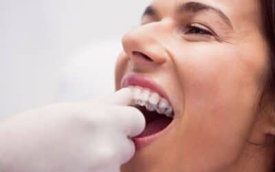 How to Care for Your Teeth and Invisalign Aligners