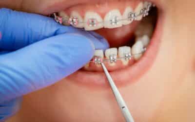 Orthodontic Excellence in Asheville: What Sets Us Apart