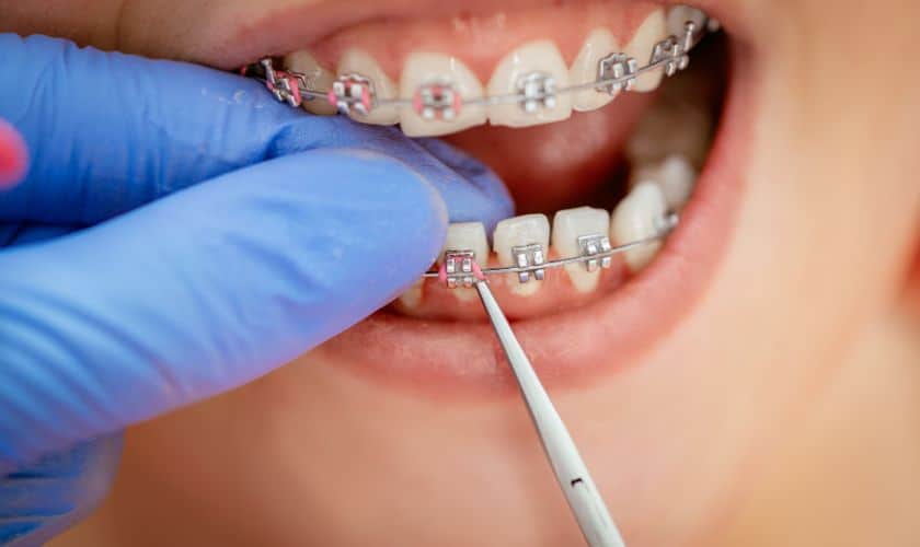 Orthodontist in Asheville