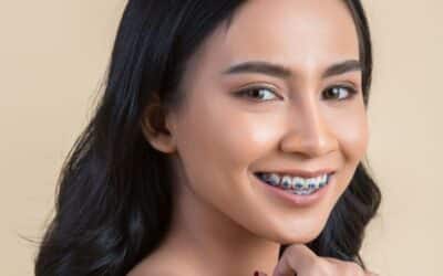 The Science of Smiles: How Metal Braces Work Their Magic