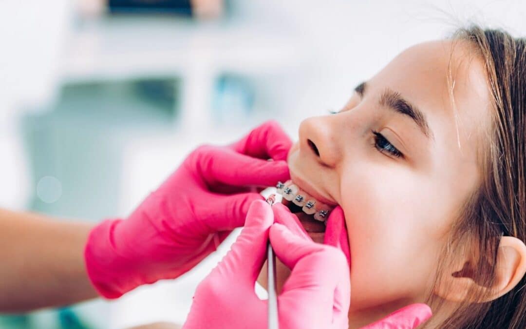 Teen girl having braces treatment under guidence of oral surgeon and orthodontist