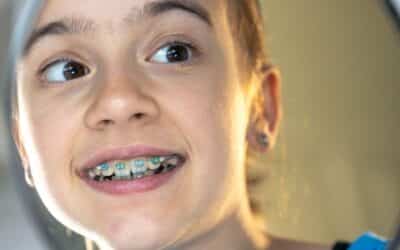 Colorful Confidence: Metal Braces for Kids