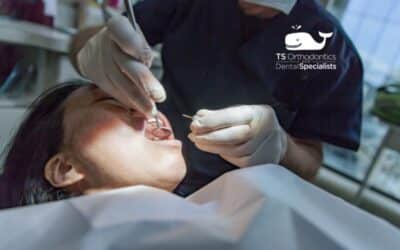 Complete Guide to Oral Surgery in Asheville: What You Need to Know