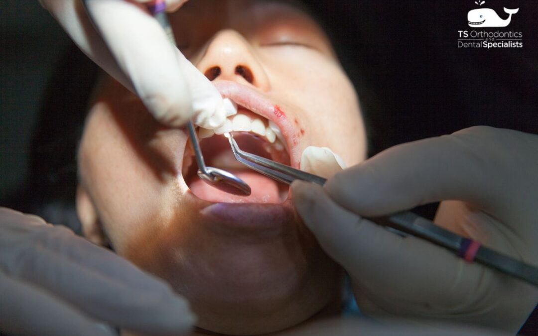 Oral Surgery in Asheville