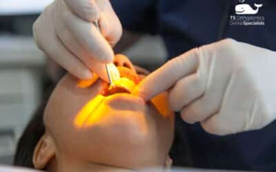 5 Common Oral Surgery Procedures in Asheville and How They Can Improve Your Health