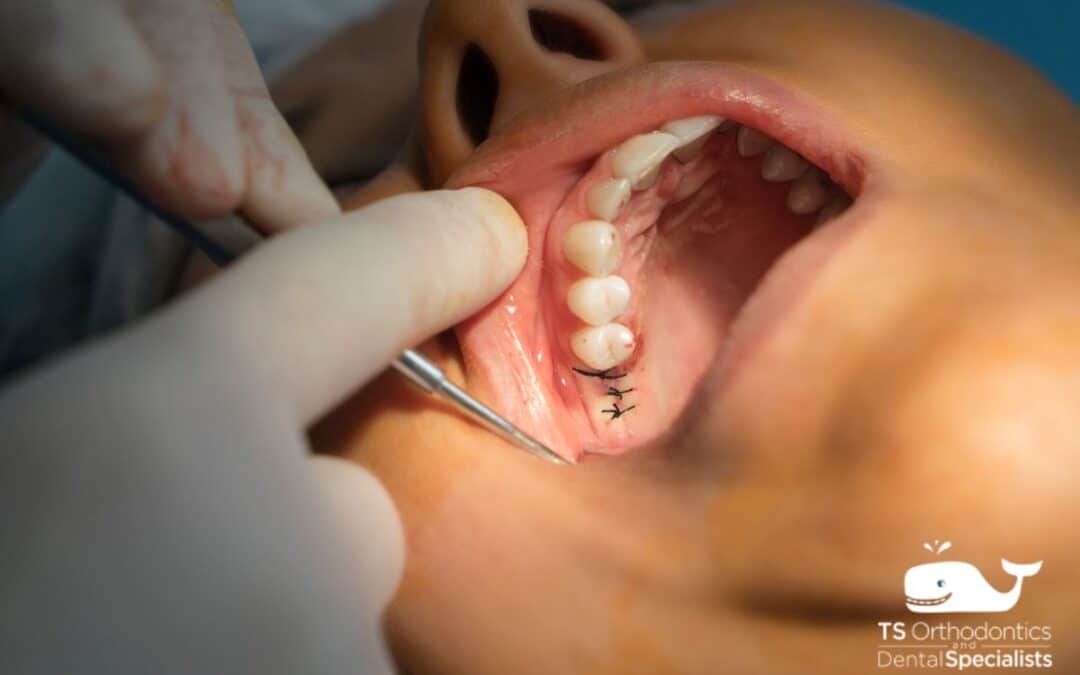 Oral Surgery Asheville
