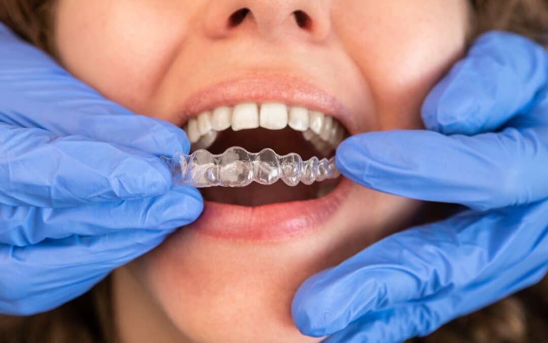 invisalign in asheville
