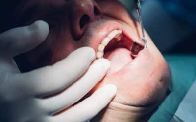 Why Experience Matters When Choosing an Oral Surgery Specialist in Asheville