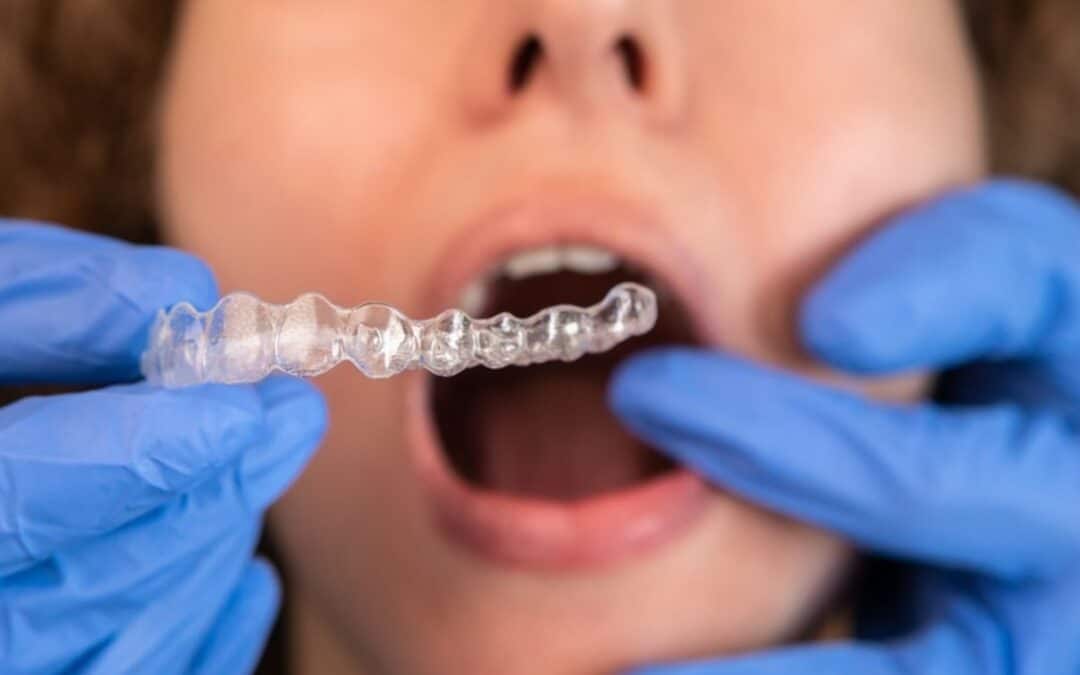 invisalign treatment asheville