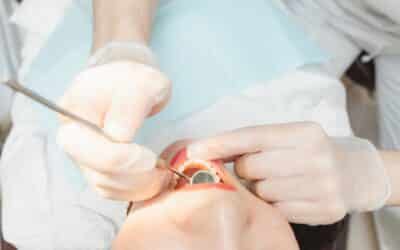 Premolar Removal for Orthodontics: What Oral Surgery Patients Should Know
