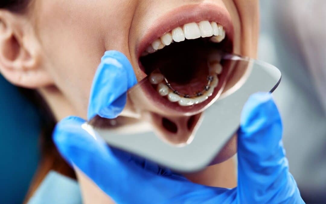 Orthodontic Relapse in Adults: When Surgery Offers a Long-Term Fix