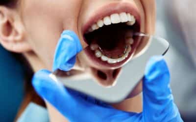 Orthodontic Relapse in Adults: When Surgery Offers a Long-Term Fix