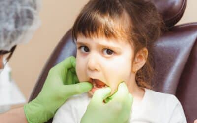Impacted Teeth in Children: Do They Need Surgery Before Braces?