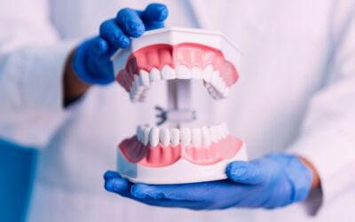 Crossbite and Jaw Surgery: When Correcting the Bite Requires More Than Braces