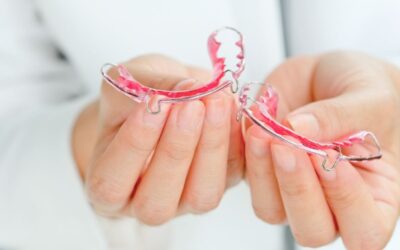 Do Retainers Need to Be Replaced Over Time?