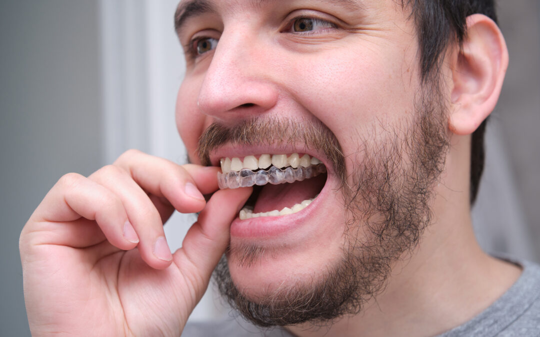 Is Invisalign Worth the Investment? A Complete Guide